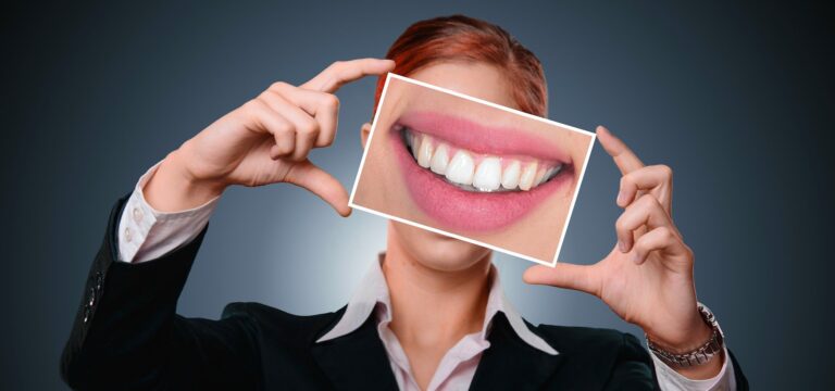 blanqueamiento dental instagram