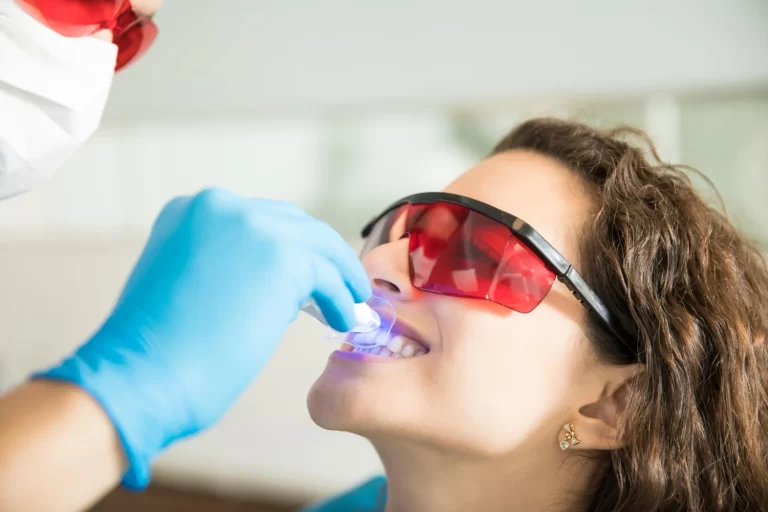¿Cómo se hace un blanqueamiento dental en clínica?