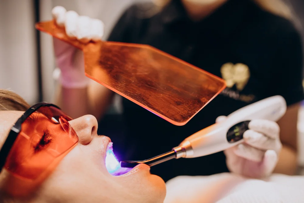 blanqueamiento dental en clinica dental