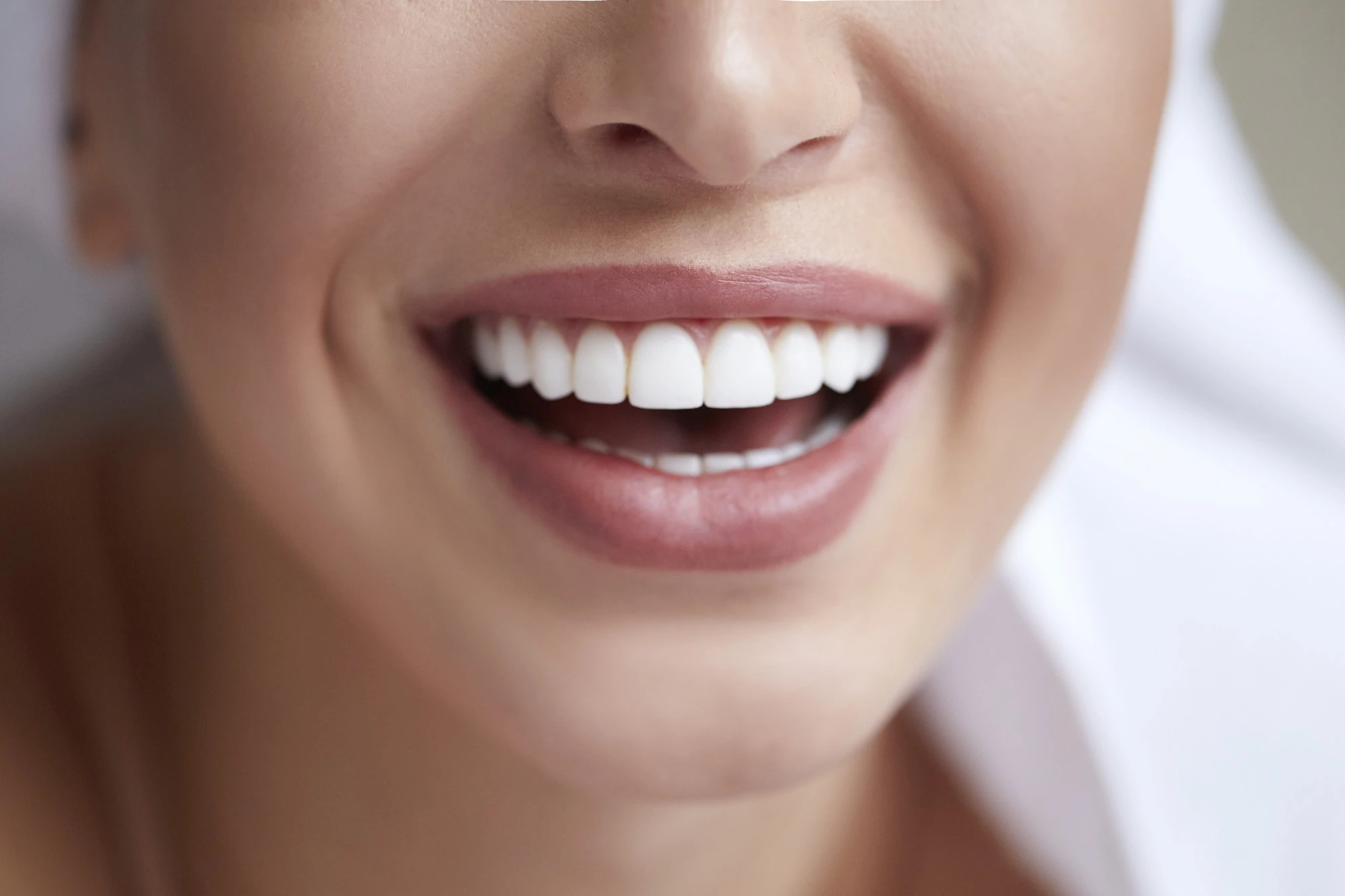 carillas-dentales-de-composite