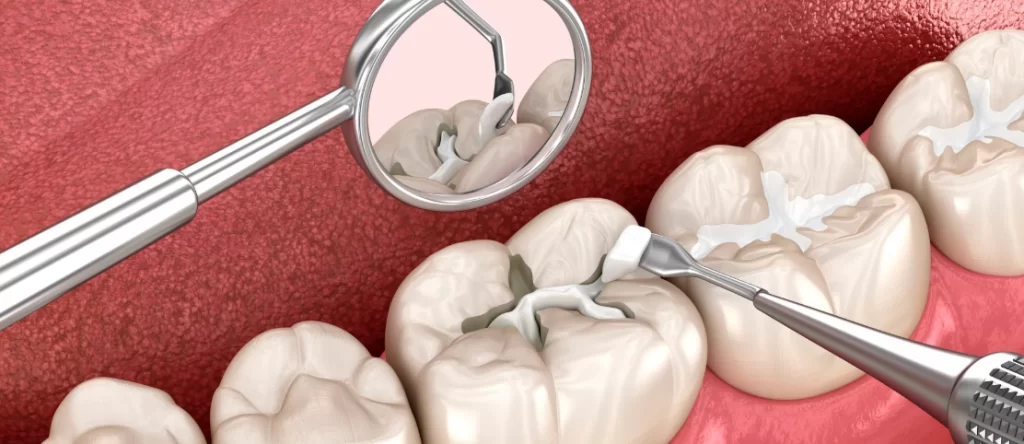 como-se-hace-empaste-dental