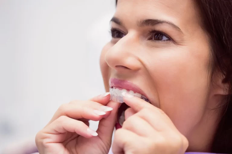 imagen portada retenedores dentales