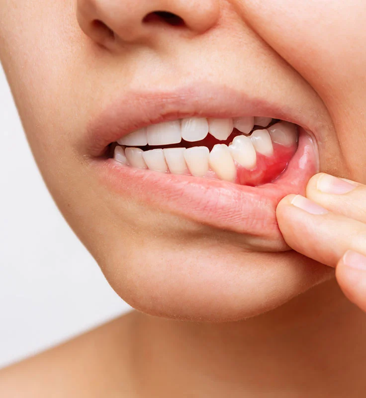 ortodoncias_brackets