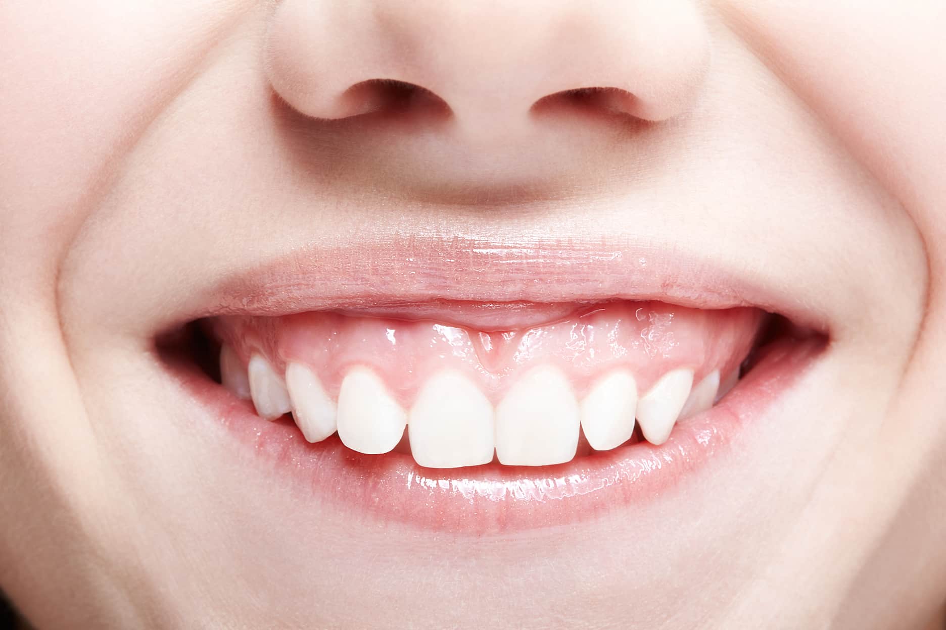 portada gingivectomia